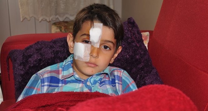 Köpek çocuğun yüzünü ısırdı