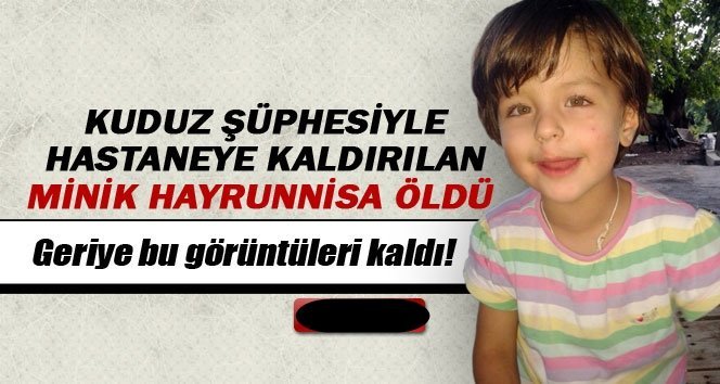 Kuduz şüphesiyle hastaneye kaldırılan çocuk öldü