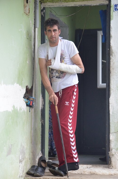 BEL FITI?I AMEL?YATI ?Ç?N G?TT? KOLU YANDI AMEL?YATTA KOLU YANAN HASTADAN SAVCILI?A SUÇ DUYURUSU