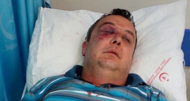 Suyunu kesen görevliyi hastanelik etti