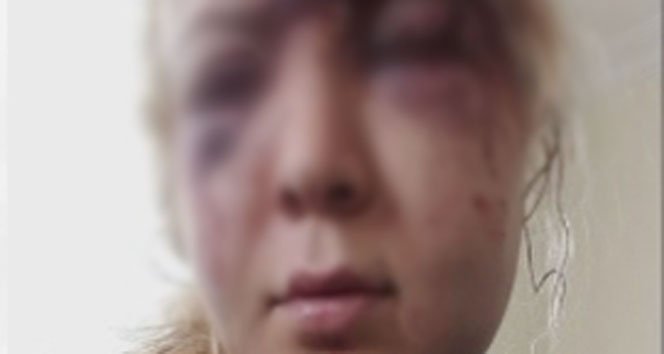 Şikayete gitti cinayetten tutuklandı