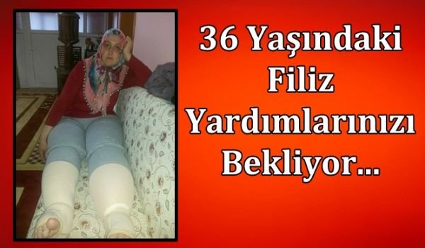 27 Yıldır Fil Hastalığı İle Mücadele Ediyor