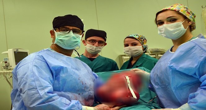 KARIN ŞİŞLİĞİNDEN GİTTİ, RAHMİNDE 4.5 KİLO UR ÇIKTI