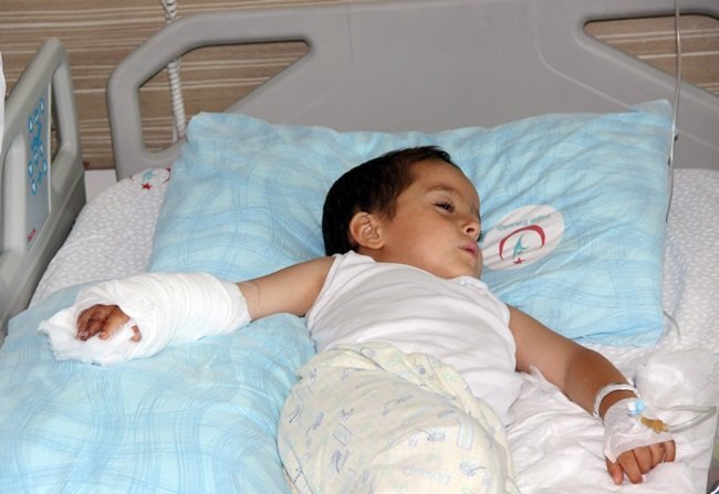 KARABÜK’ÜN SAFRANBOLU İLÇESİ’NE BAĞLI DÜZÇAM KÖYÜ’NDE OTURAN 3 YAŞINDAKİ HASAN ŞAHİN’İN, TRAKTÖRÜN ARKASINDAKİ KEPÇEDE OYUN OYNARKAN KIRILAN PARMAĞININ KOPAN DAMARLARI, MİKRO CERRAHİ YÖNTEMLE 3.5 SAATTE DİKİLDİ. (YASİN ERDEM/KARABÜK-İHA)