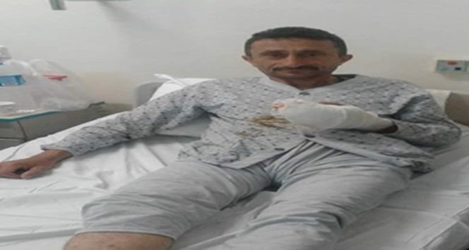 Fındık patozuna elini kaptırdı, parmakları koptu