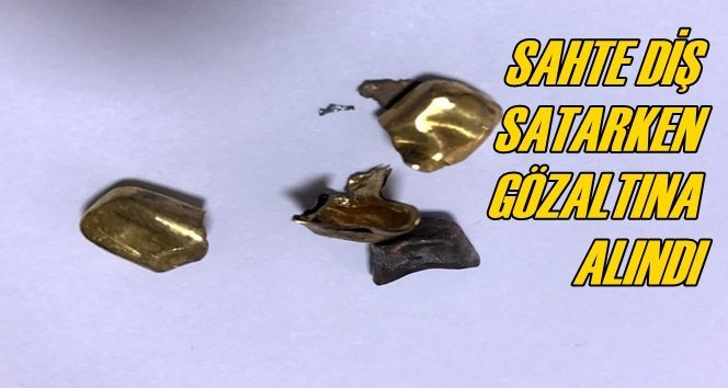 Kuyumcuya Sahte Altın Diş Satmaya Çalıştı