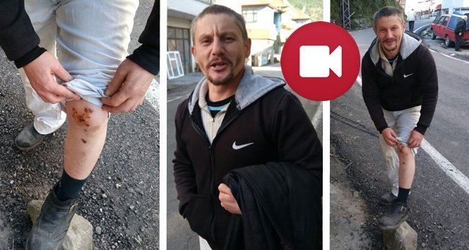 Ölümden Kıl Payı Dönen Sürücü Konuştu