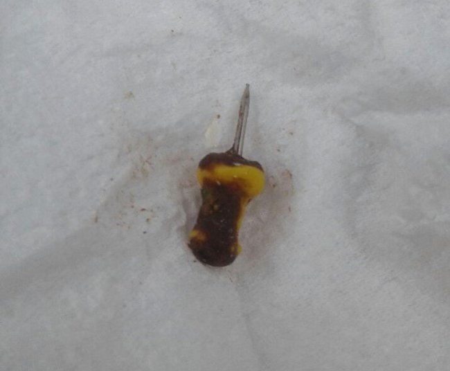 KASTAMONU’DA YILBAŞI GECESİ İÇİN BEDAVA DAĞITILAN PASTANIN İÇERİSİNDEN ÇIKTIĞI İLERİ SÜRÜLEN RAPTİYE, 9 YAŞINDAKİ KÜÇÜK KIZ ÇOCUĞUNUN BOĞAZINA TAKILDI. (İHA/KASTAMONU-İHA)