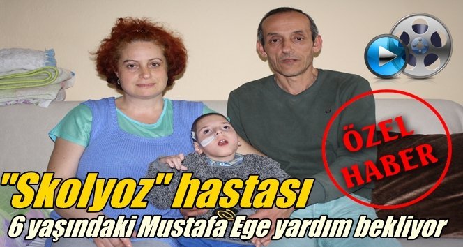 Filyos’ta 6 yaşındaki “Skolyoz” hastası Mustafa Ege için kolları sıvama vakti!.