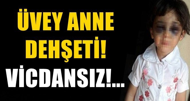 3,5 yaşındaki üvey kızını hastanelik etti!.