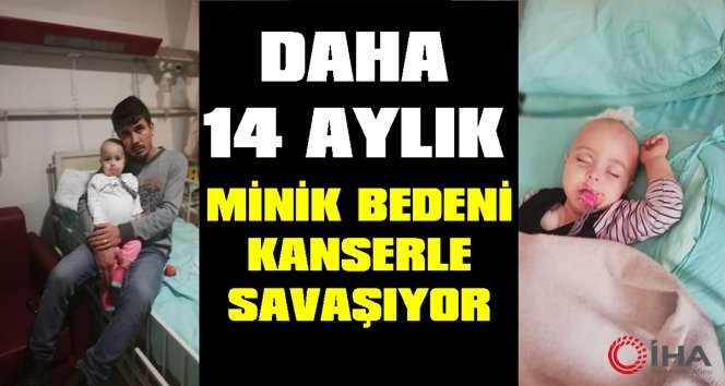 14 aylık Zekiye bebek kanserle savaşıyor