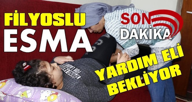 9 Yaşındaki Esma için akülü sandalyeye ihtiyaç var!.