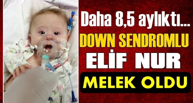 Kalp yetmezliği bulunan Elif Nur hayata tutunamadı!.
