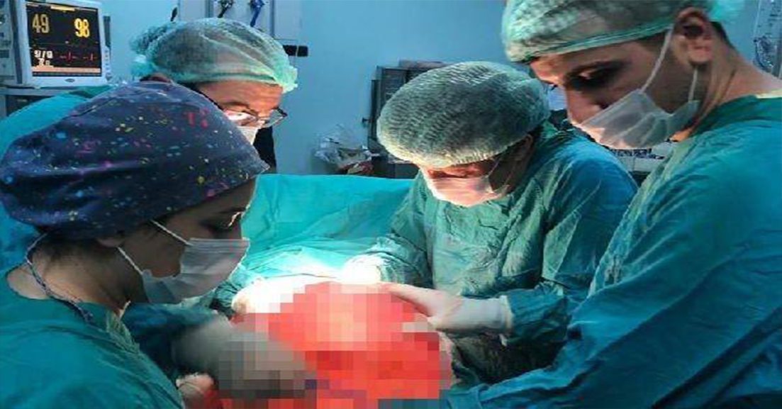 Zonguldak’ta karın şişliği şikayetiyle hastaneye başvuran kişiden 14 kilogram kitle çıkarıldı